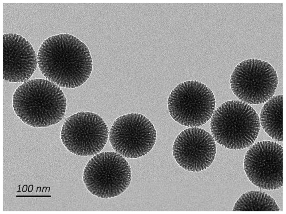 Methotrexate transdermal local controlled release preparation and its preparation method and application