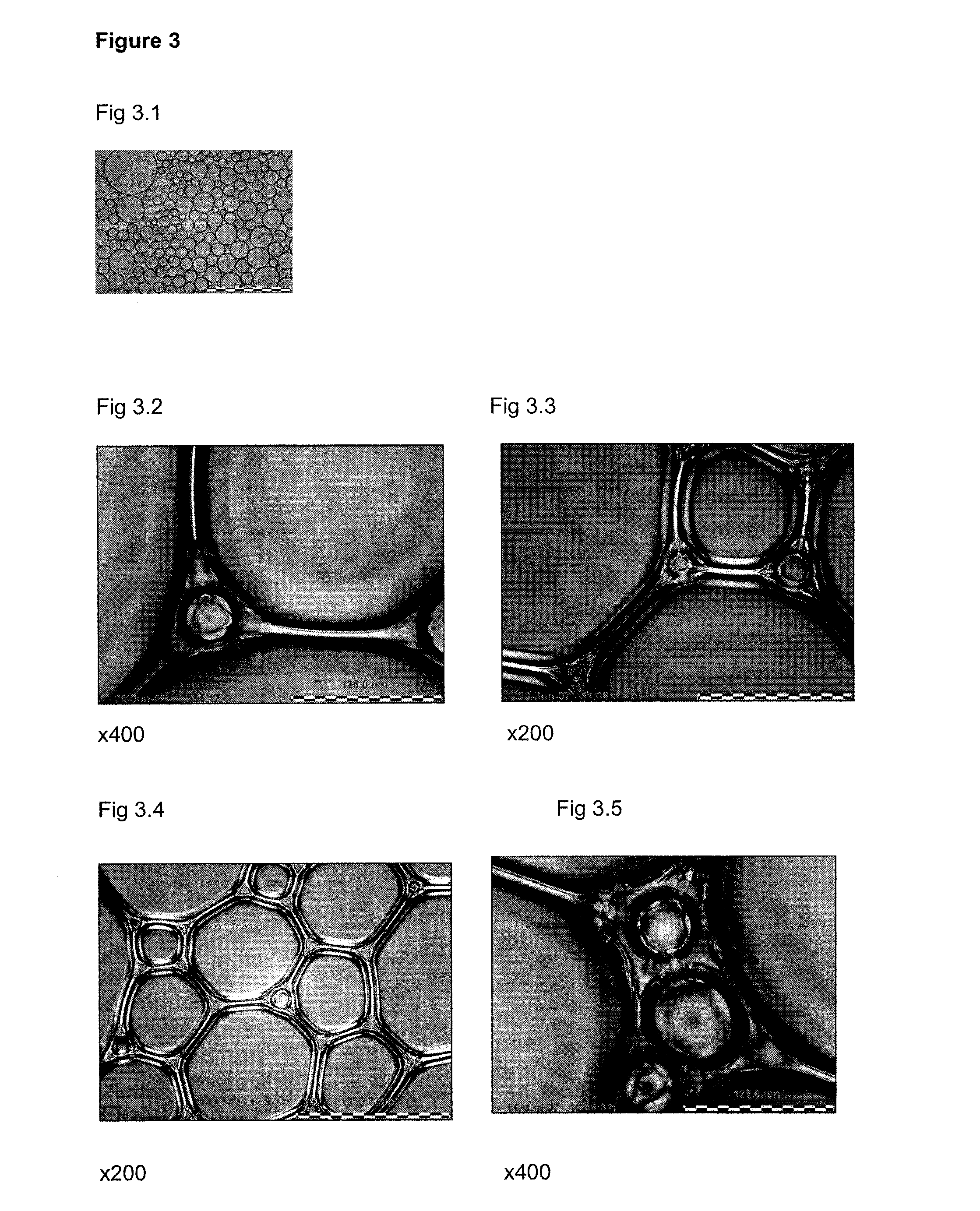 Foamable Compositions and Kits Comprising One or More of a Channel Agent, a Cholinergic Agent, A nitric Oxide Donor and Related Agents and Their Uses