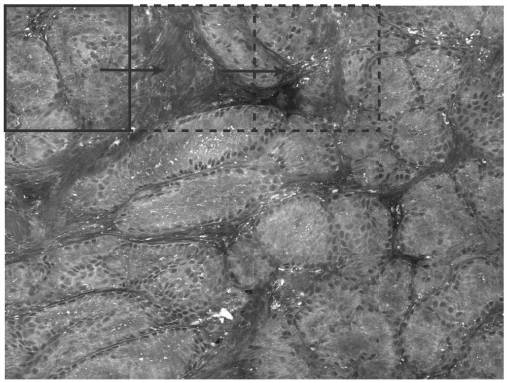 Endogastric biopsy histopathologic imaging method based on stimulated Raman scattering