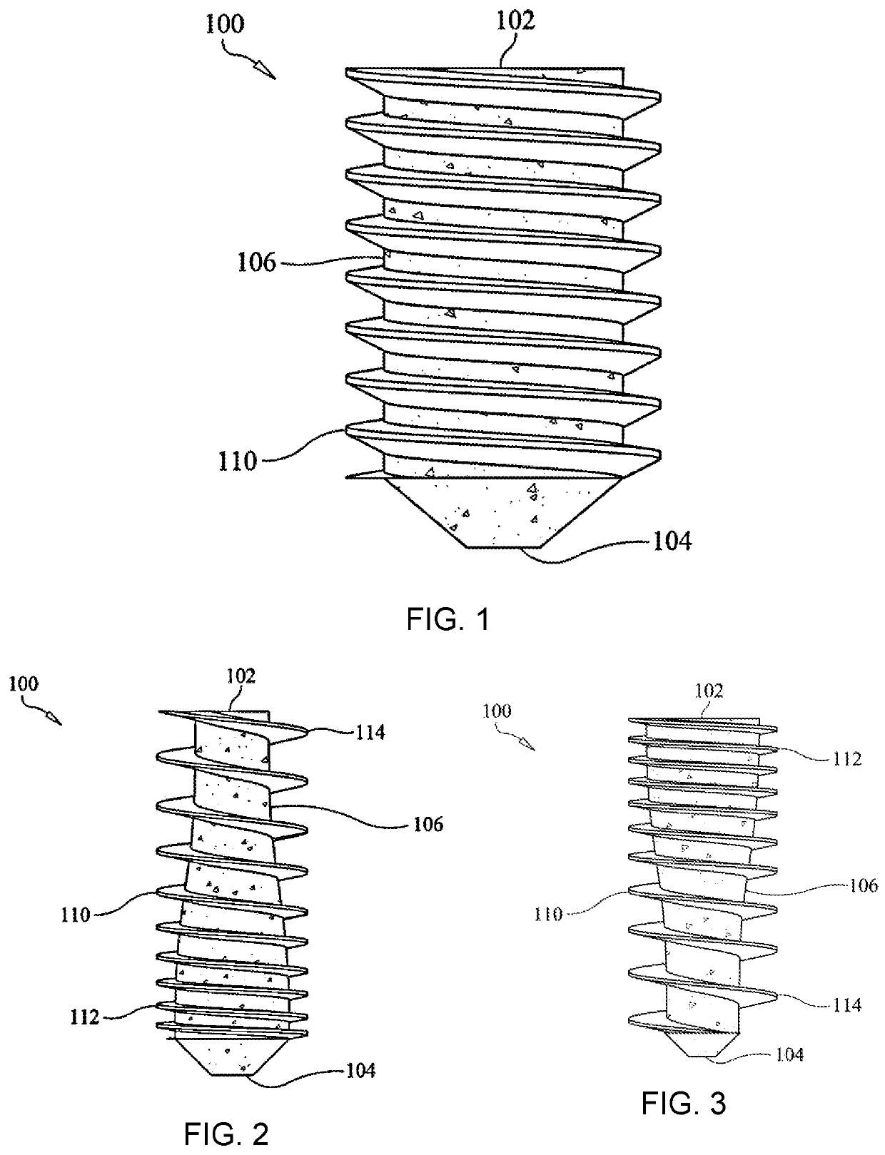 Screw bone implant