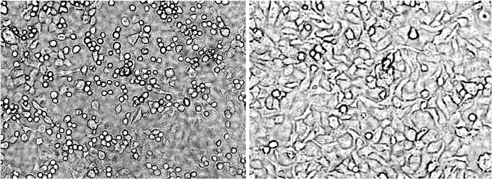 Application of lycorine in preparing medicament for treating diseases caused by human enterovirus 71 type infection