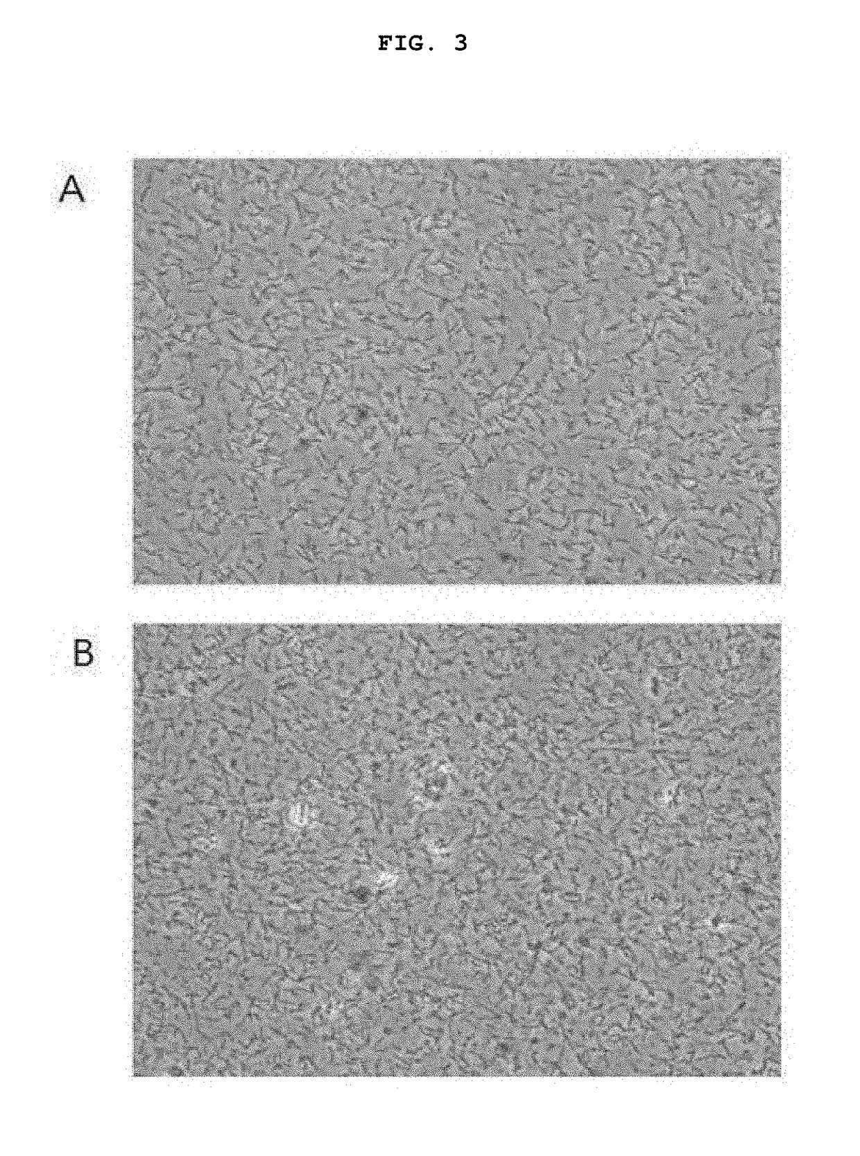 Functional hydrated hyaluronic acid and method for producing coated lactic acid bacteria having excellent intestinal mucoadhesive ability and selective antagonistic action using same