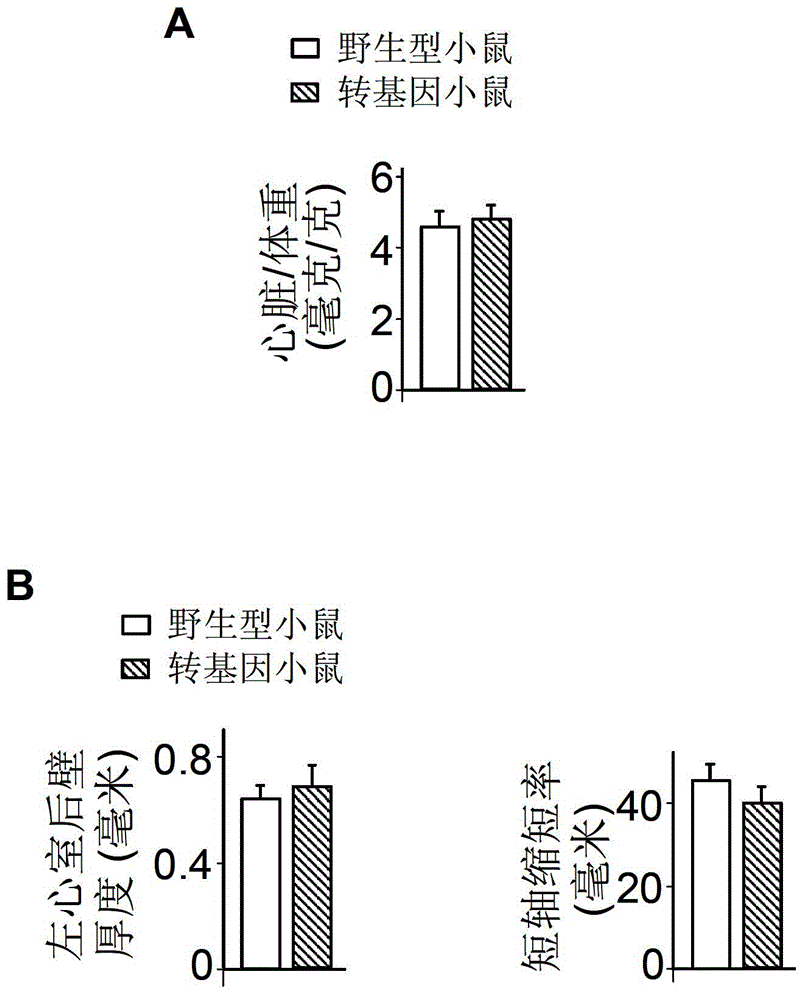 MiRNA (micro ribose nucleic acid)-874 and application of miRNA-874antisense nucleotide