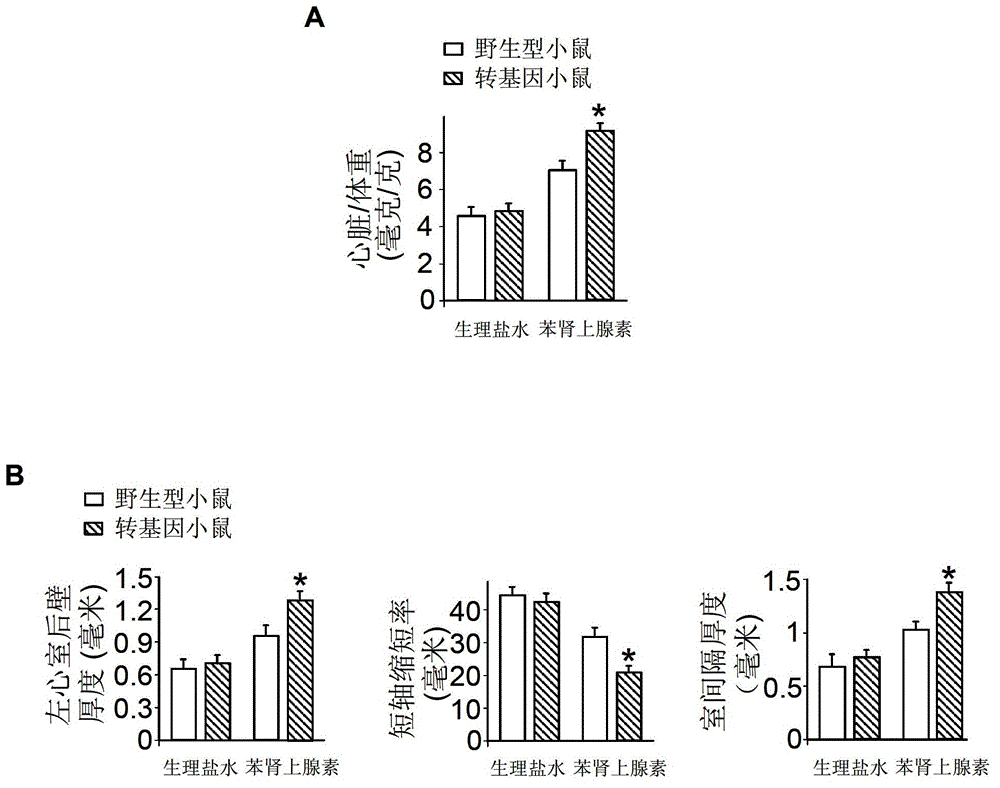 MiRNA (micro ribose nucleic acid)-874 and application of miRNA-874antisense nucleotide