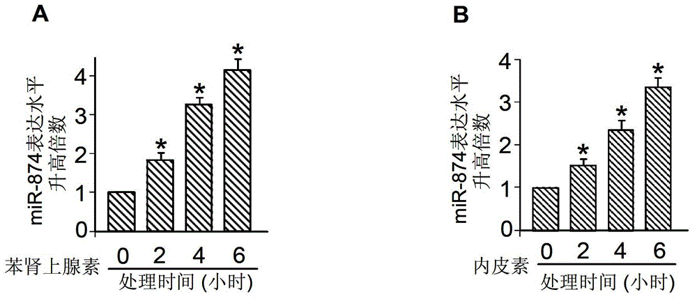 MiRNA (micro ribose nucleic acid)-874 and application of miRNA-874antisense nucleotide