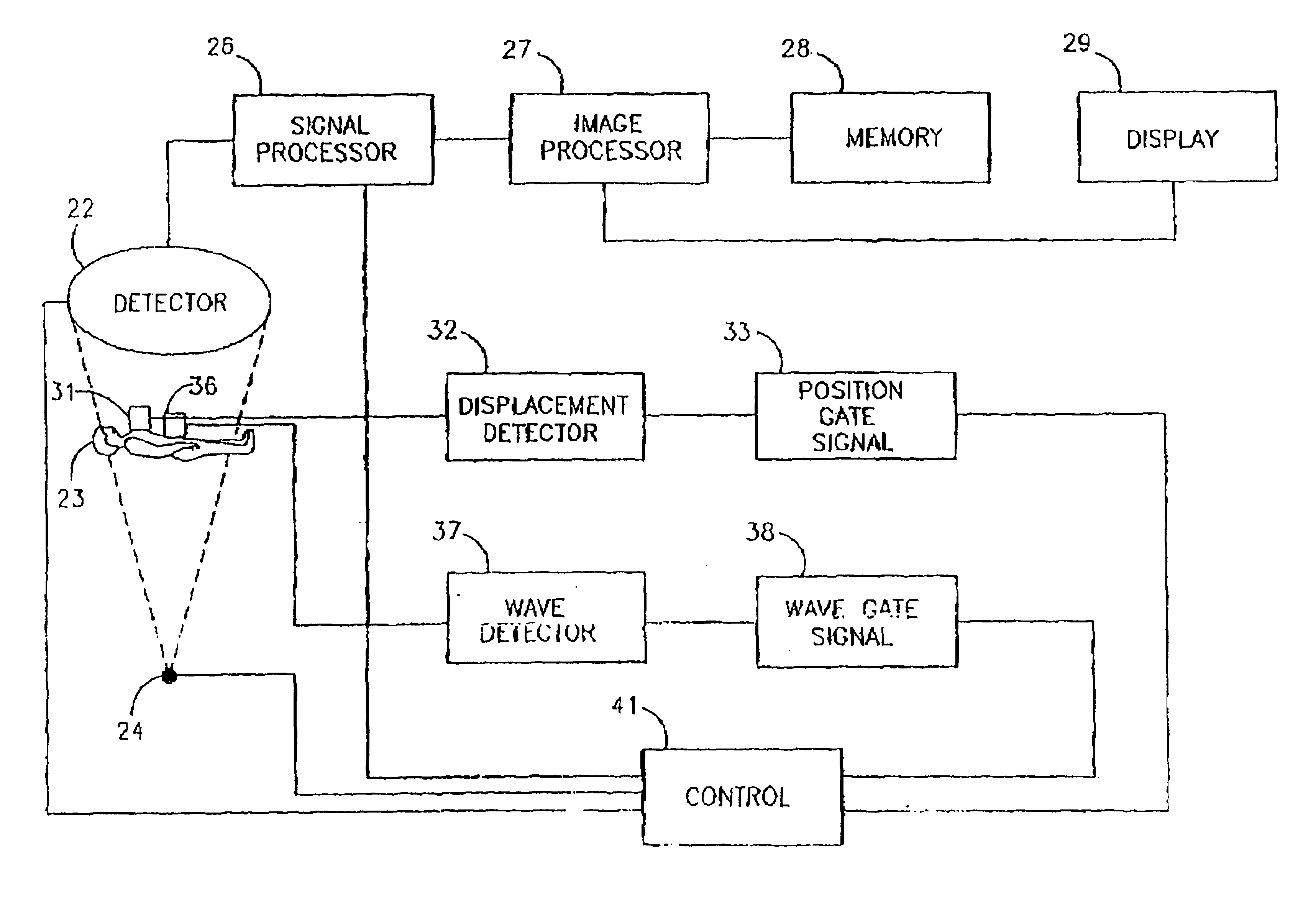 Registration of nuclear medicine images