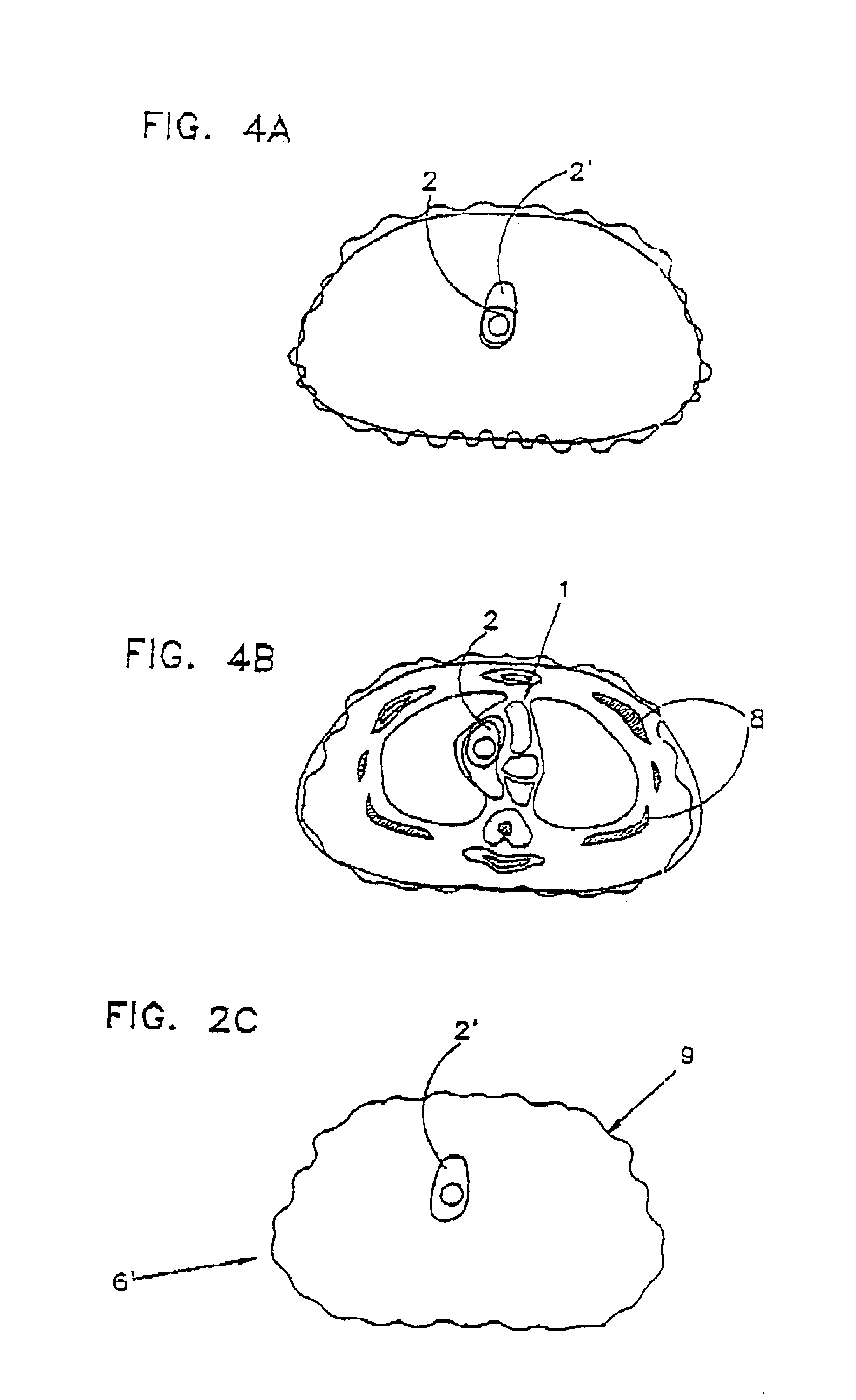 Registration of nuclear medicine images