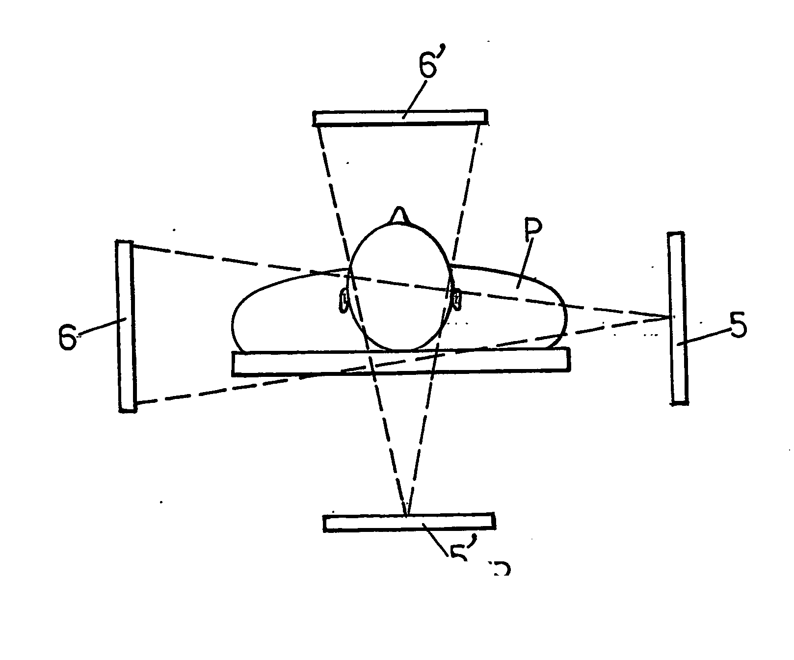 Method and device for radiographic imaging