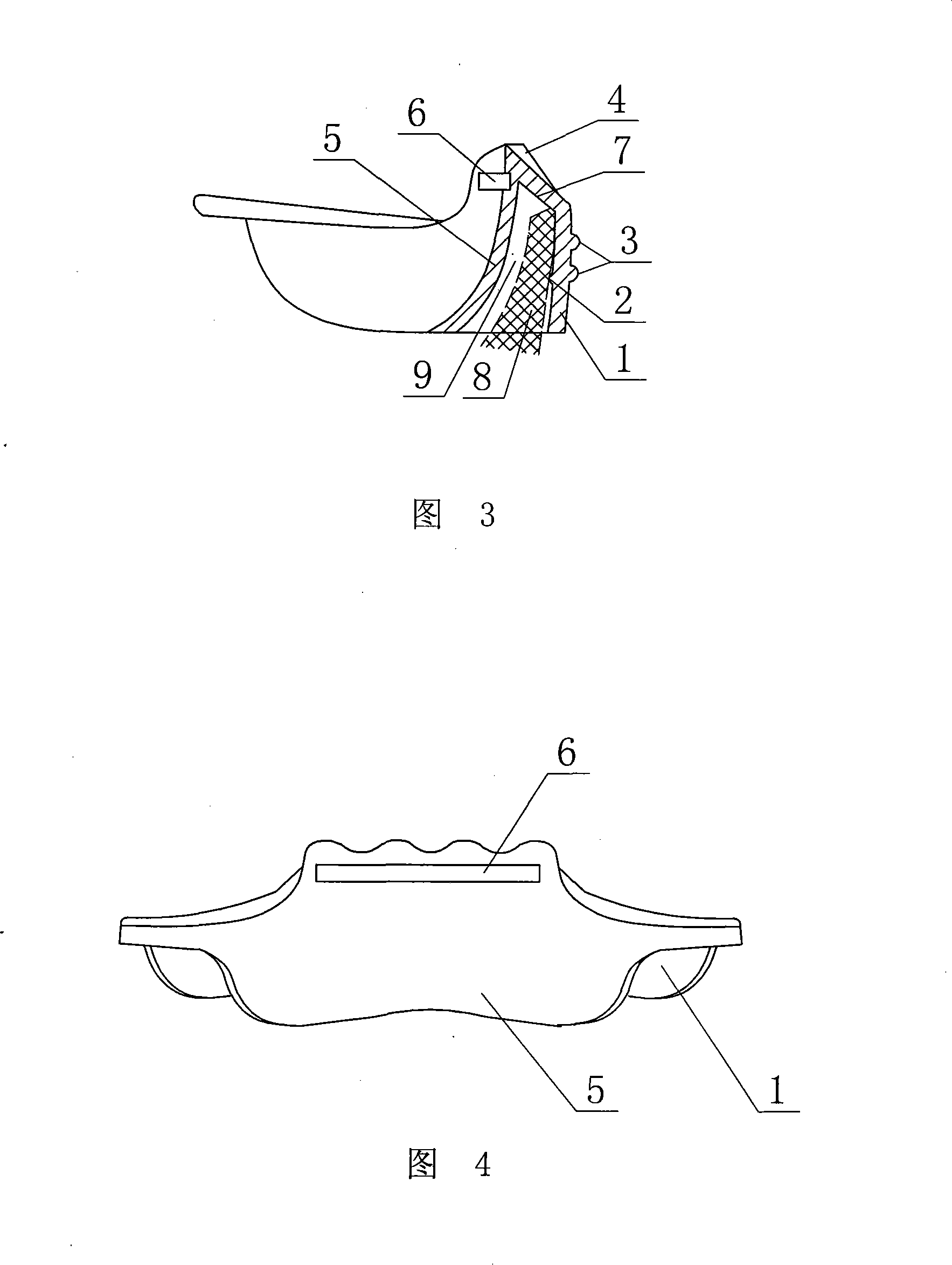 Anterior teeth unusual occlusion appliance