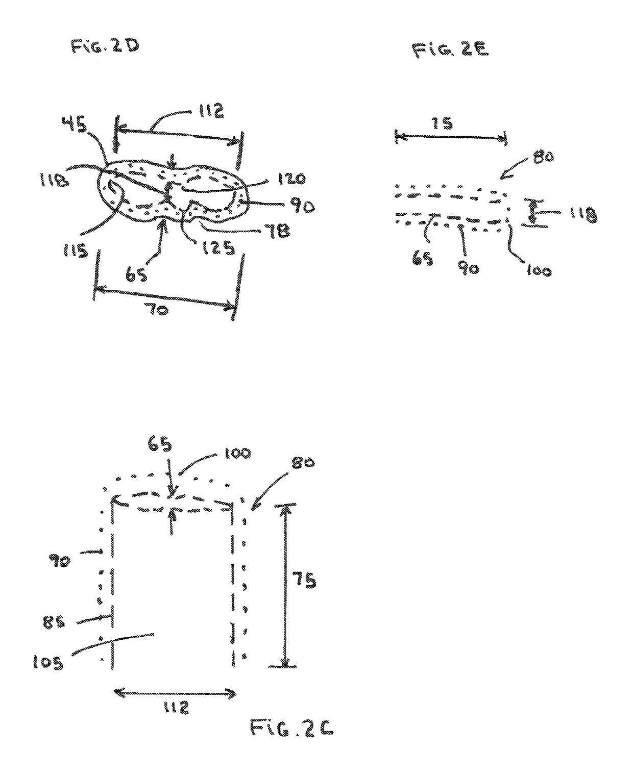 Perivalvular occlusion device and methods