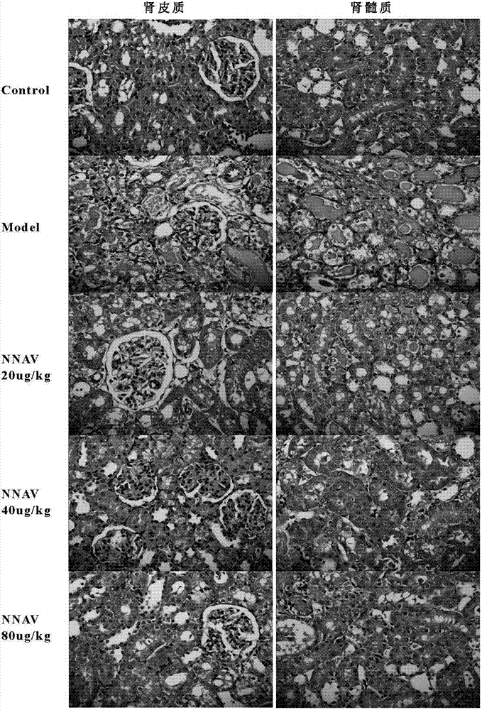 Application of physically-modified Chinese cobra venom in preparation of medicament for treating acute and chronic nephrosis