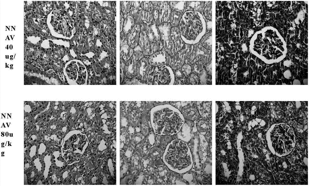 Application of physically-modified Chinese cobra venom in preparation of medicament for treating acute and chronic nephrosis