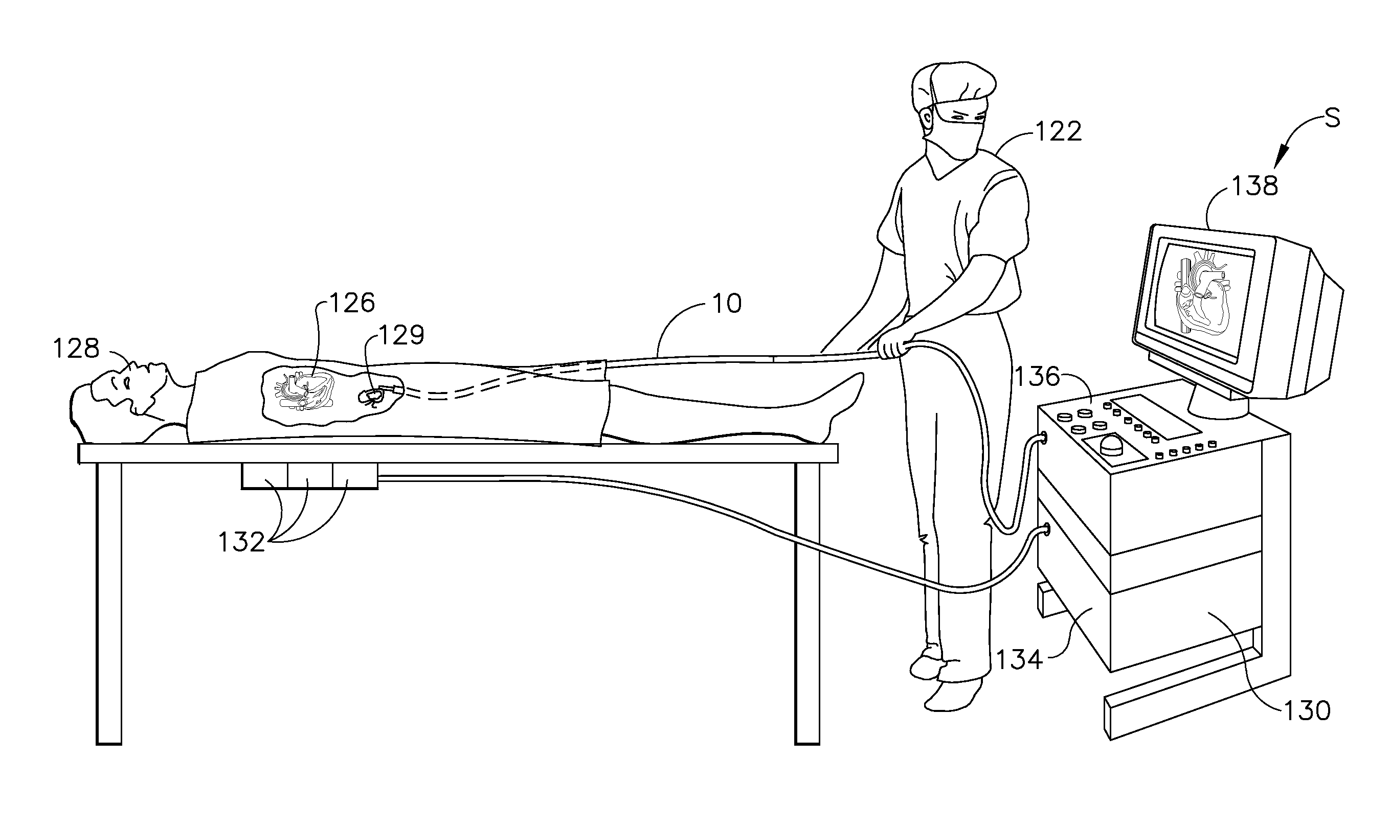 Catheter with helical end section for vessel ablation