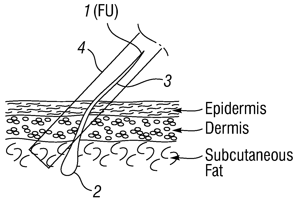 System and method for harvesting and implanting hair using image-generated topological skin models