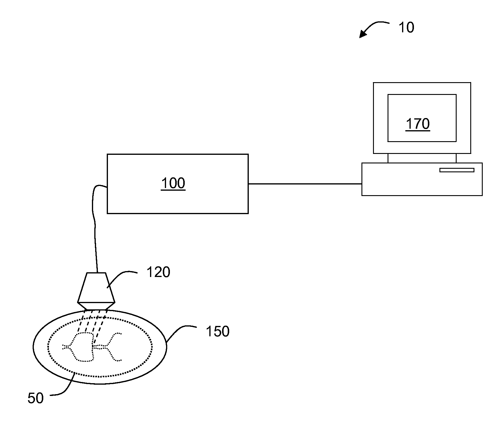 Method and system for imaging vessels