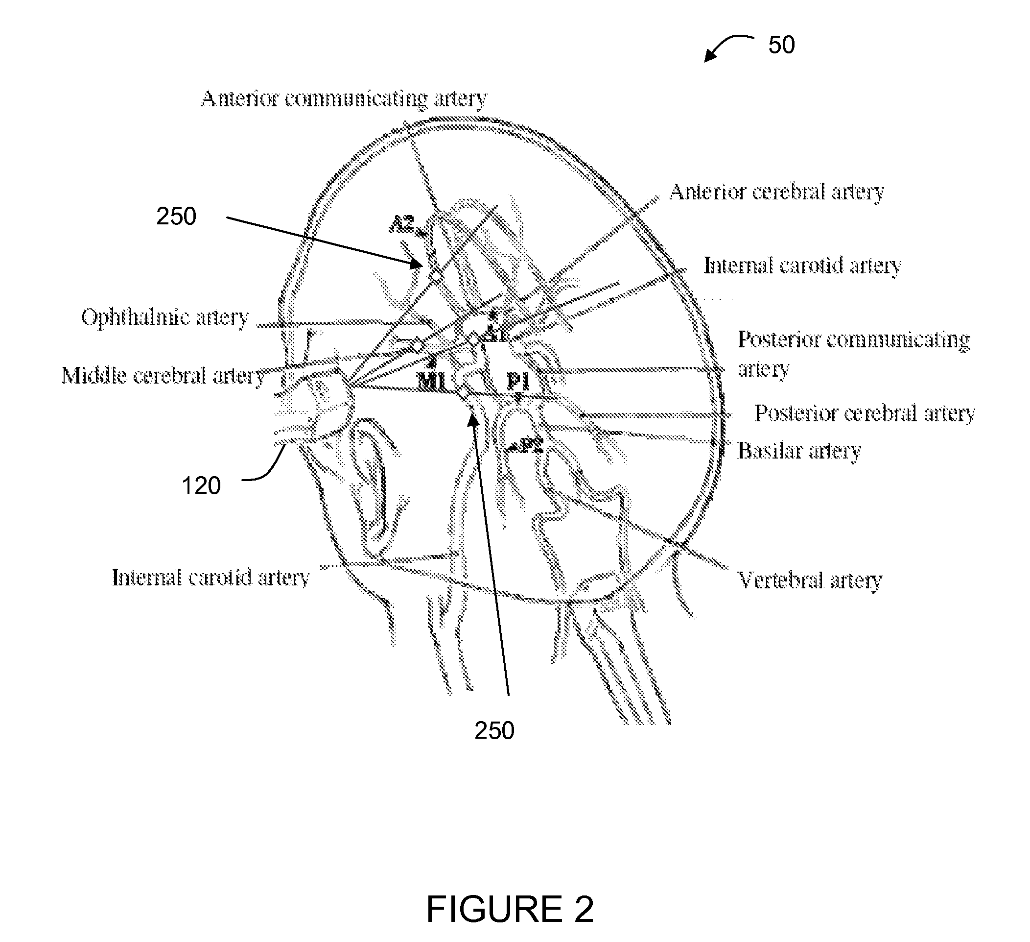 Method and system for imaging vessels