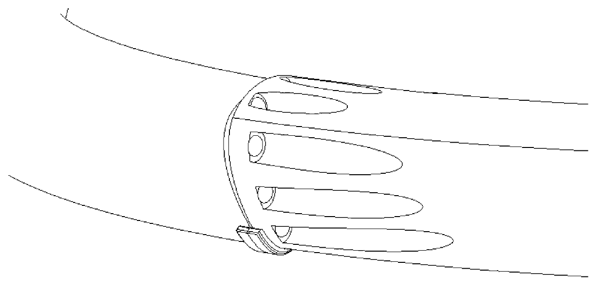 Vertically fixed substitute prosthesis for occlusalf surface