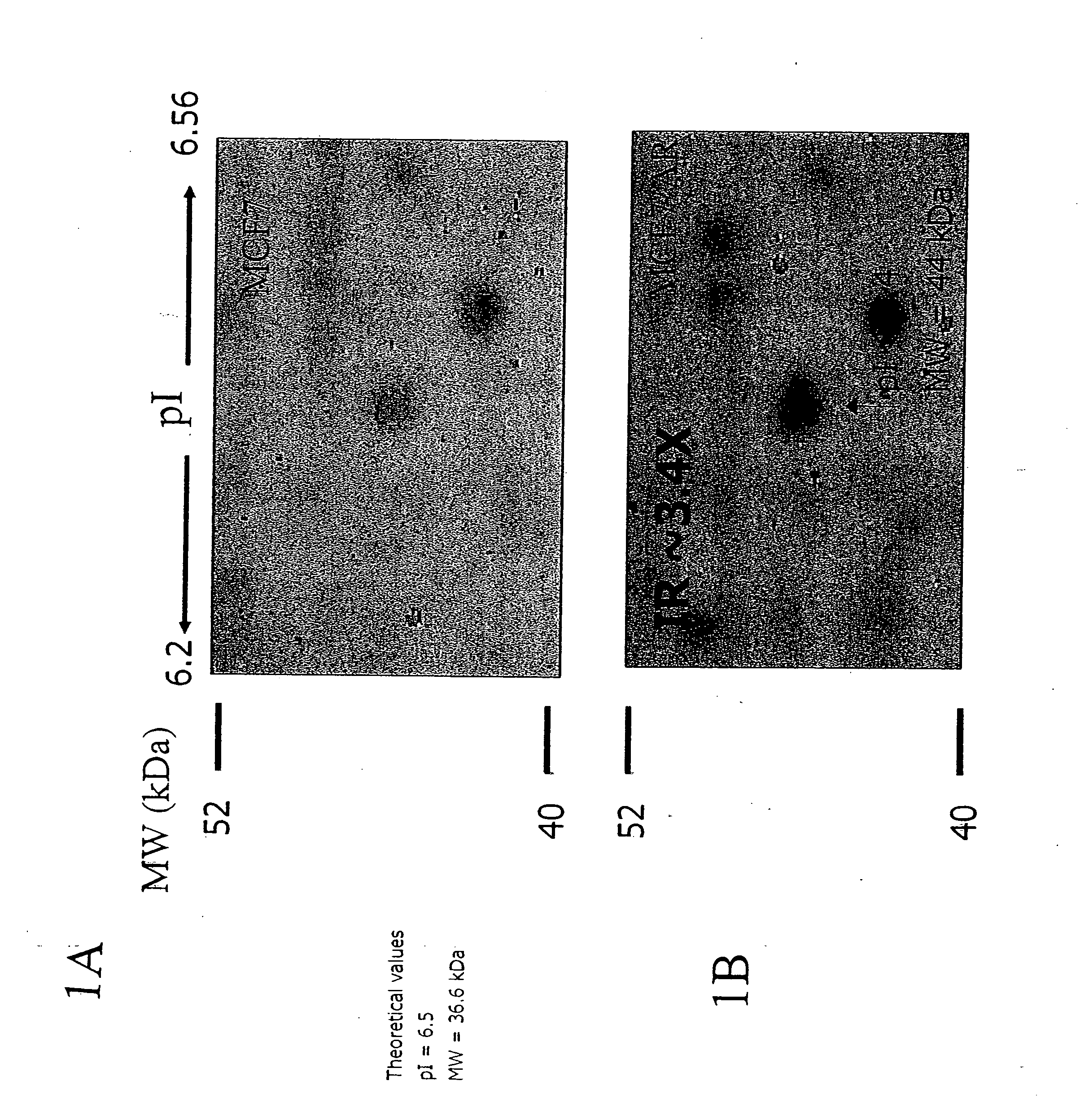 Alpha enolase-directed diagnostics and therapeutics for cancer and chemotherapeutic drug resistance