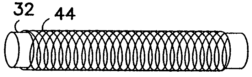 Porous synthetic vascular grafts with oriented ingrowth channels