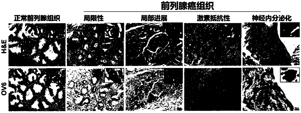 Prostatic cancer stem cell marker, application of antibody OV6 in preparation of prostatic cancer stem cell marking material and marking method