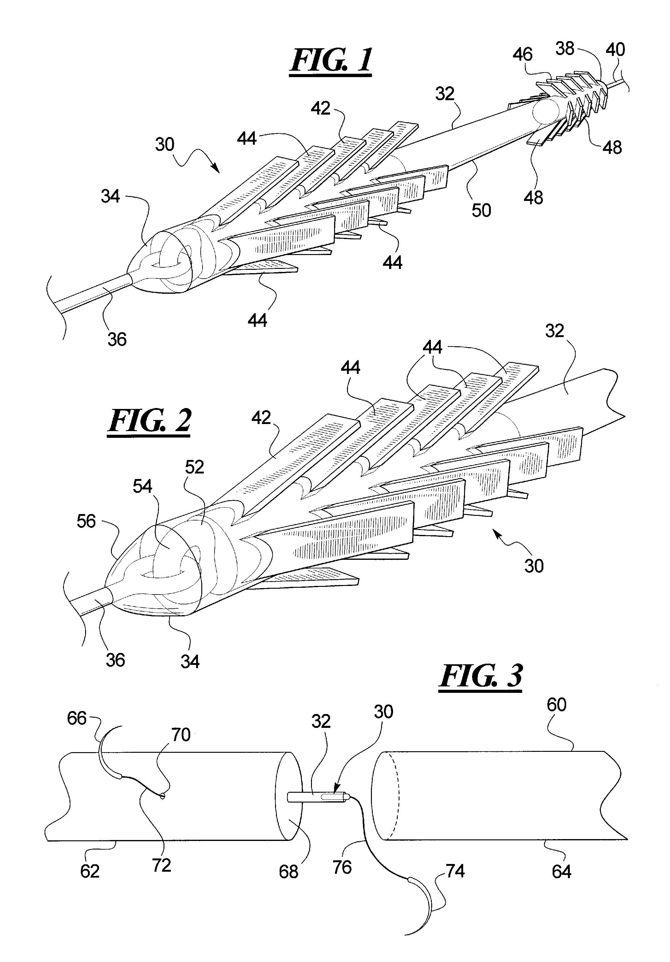 Tendon repair apparatus and method