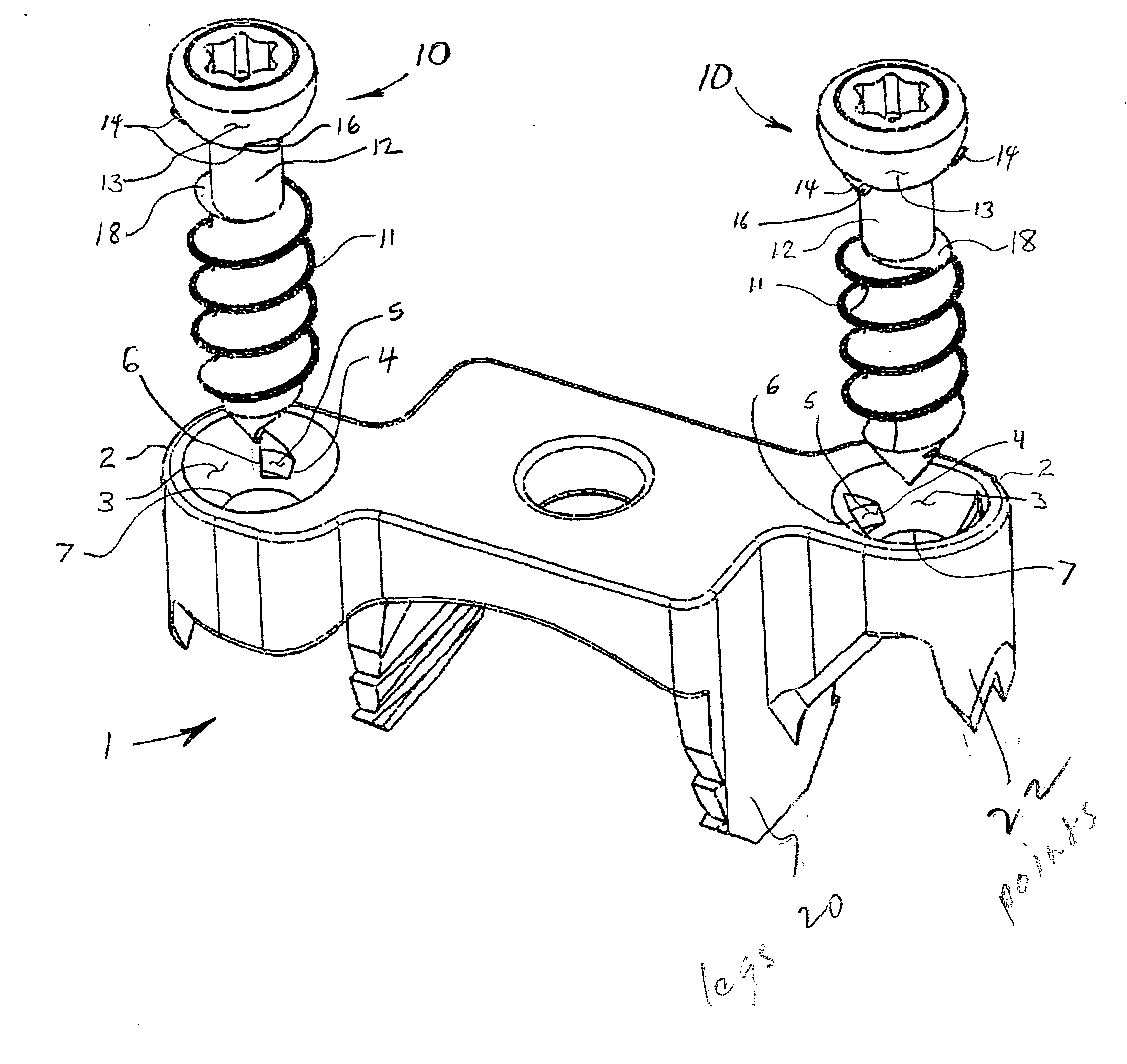 Implant with integral fastener retention