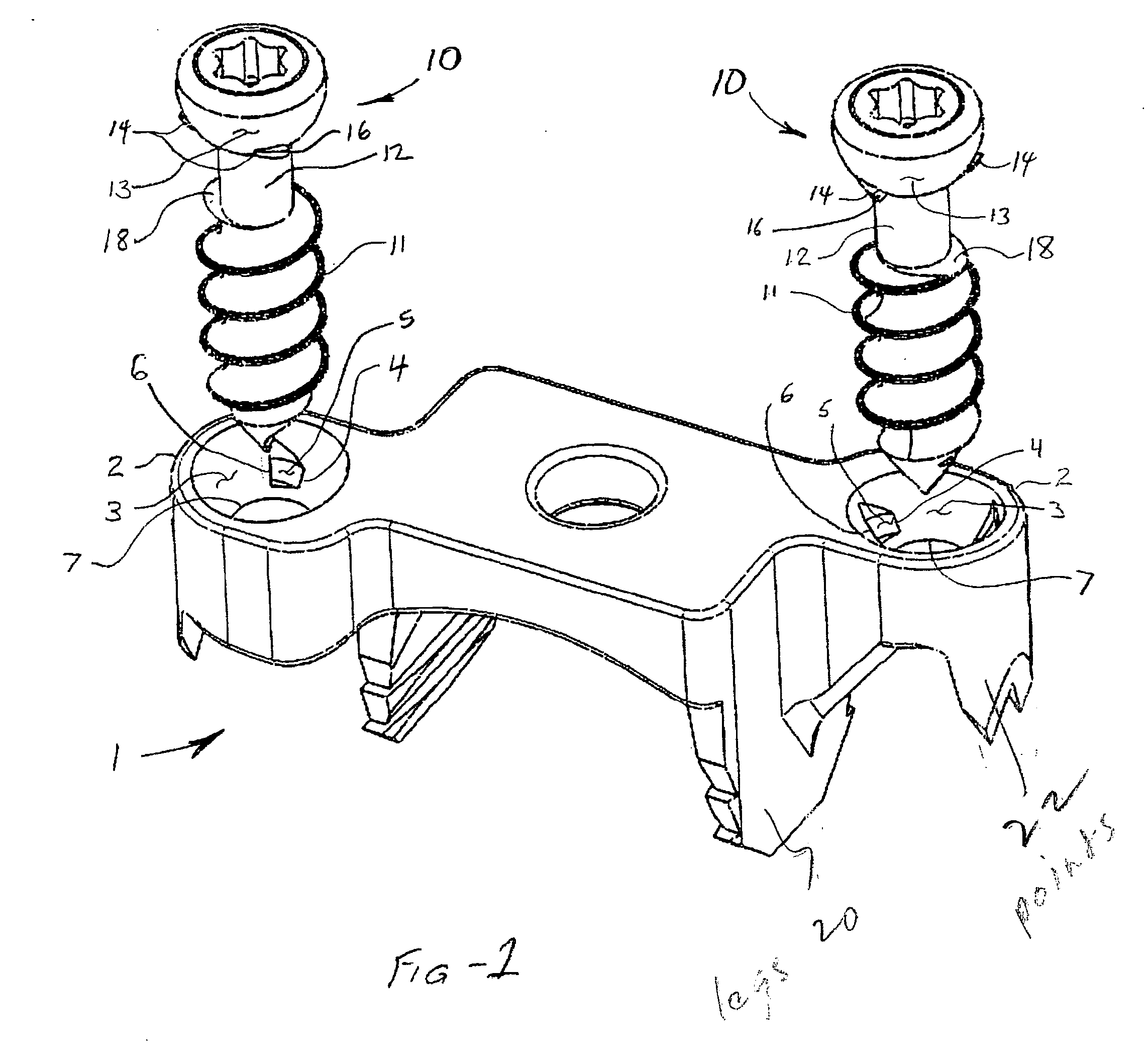 Implant with integral fastener retention