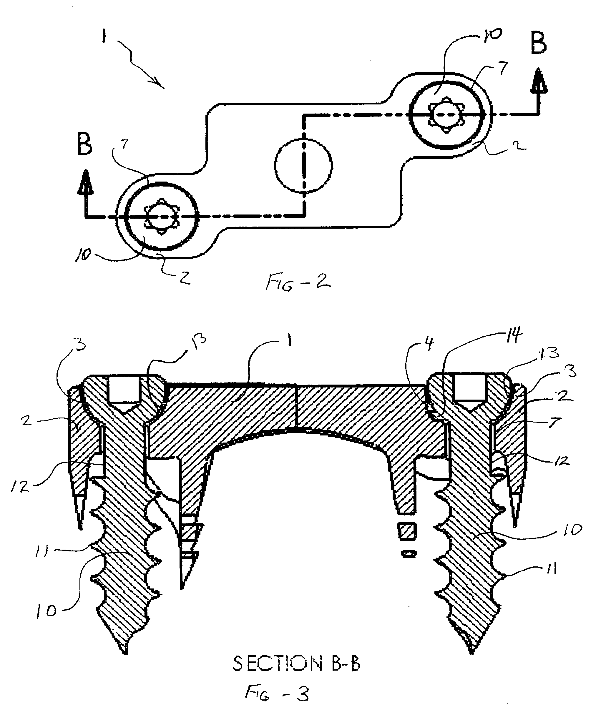 Implant with integral fastener retention