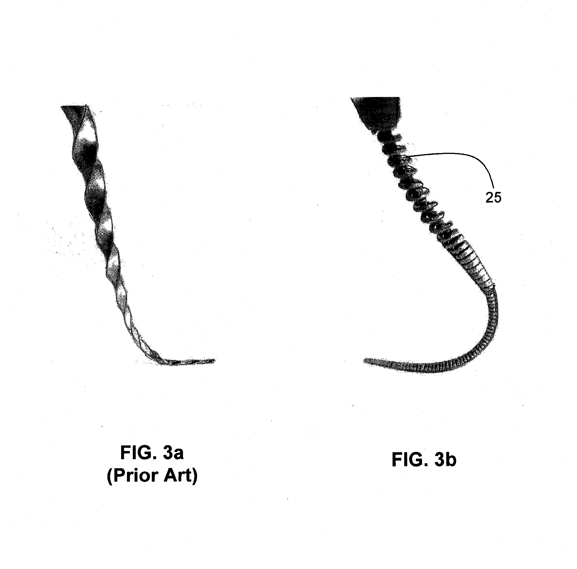 Endodontic file having an outer spiral cord