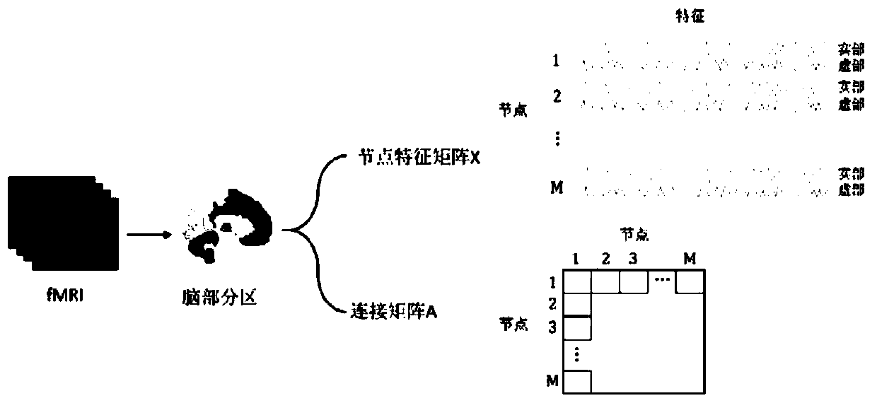 Brain image processing method, computer equipment and readable storage medium