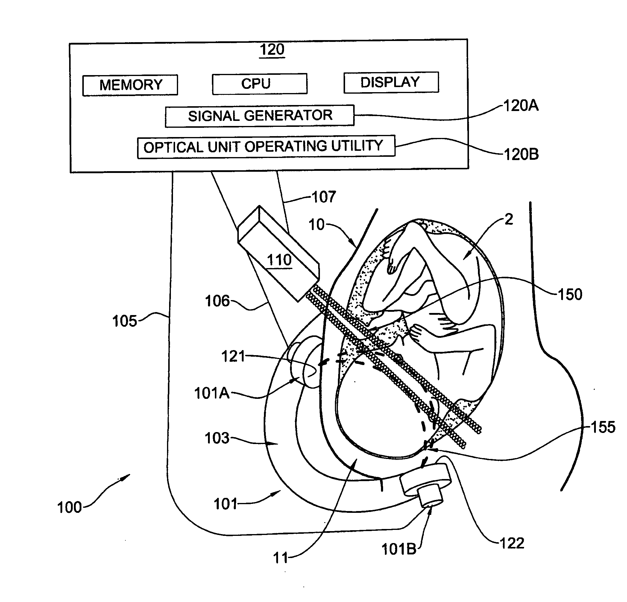 Method and apparatus for noninvasively monitoring parameters of a region of interest in a human body