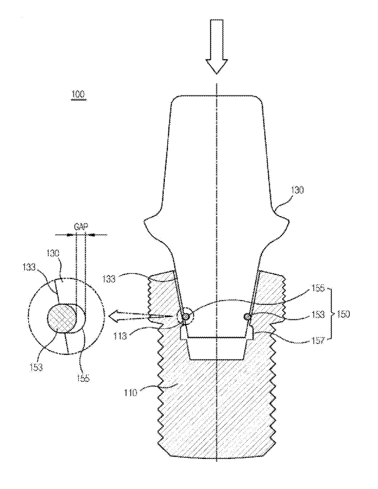 Easily retrievable implant-abutment device