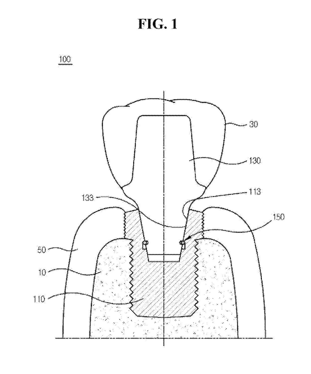 Easily retrievable implant-abutment device