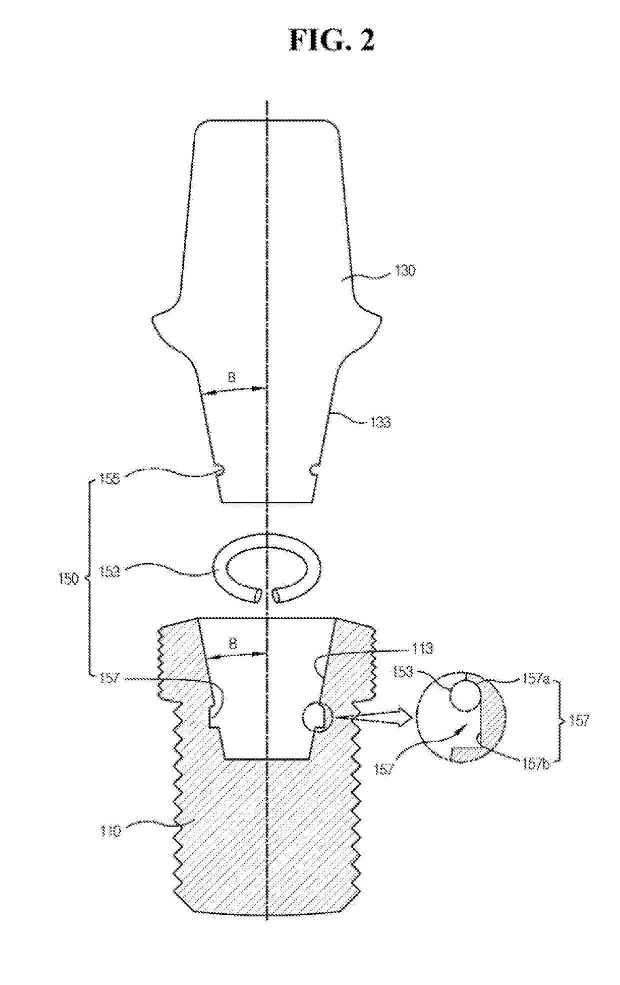 Easily retrievable implant-abutment device