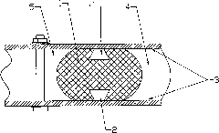 Sealing ring