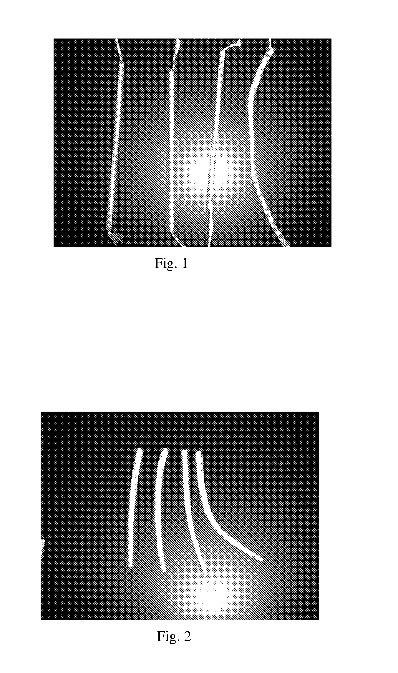 High-strength biological scaffold material and preparation method thereof