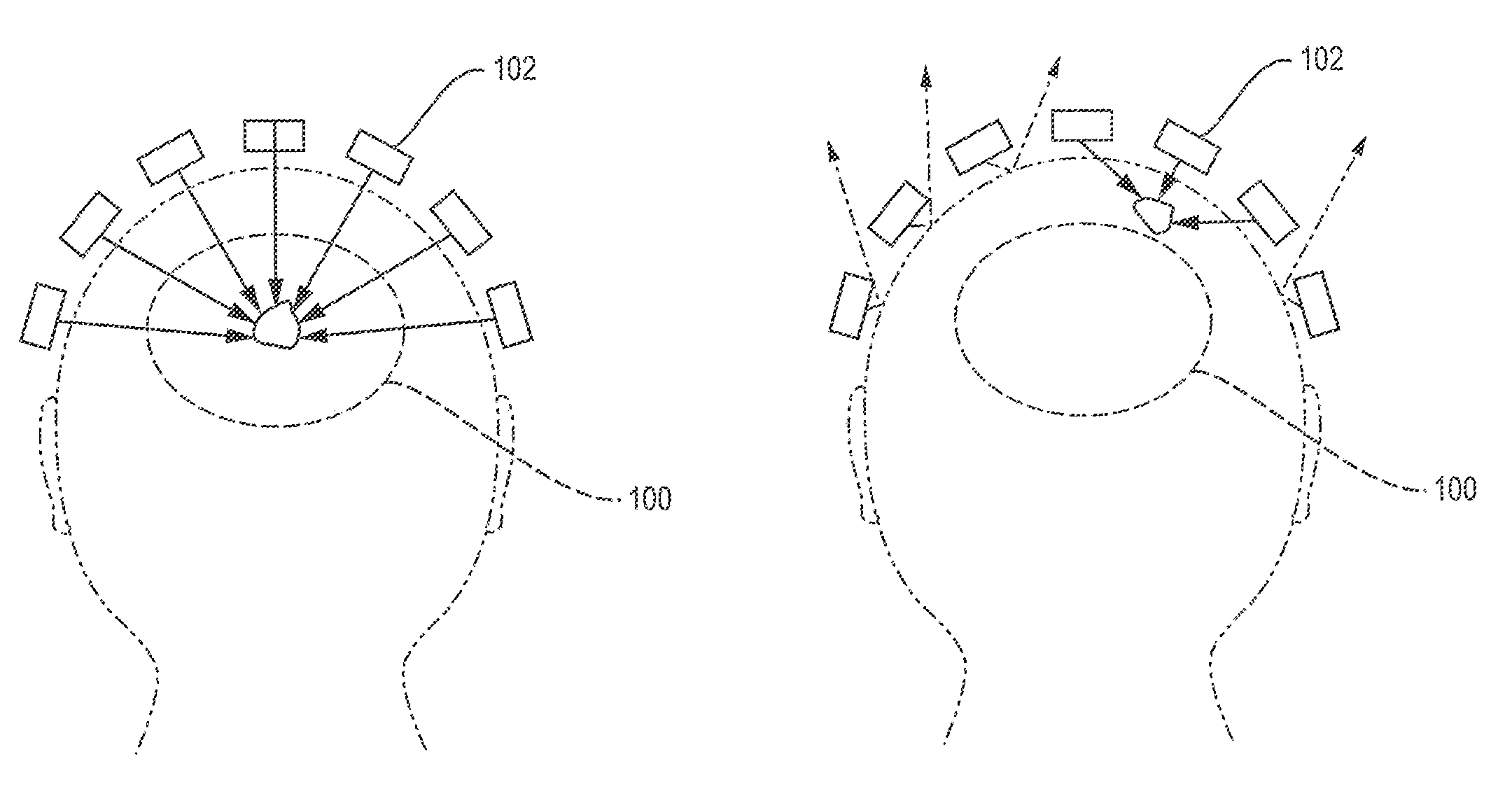 Focusing ultrasound into the brain through the skull by utilizing both longitudinal and shear waves