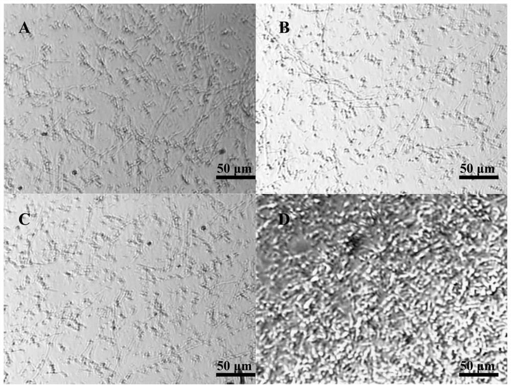 Ox-bile-tolerant bezoar transformation bacterium screening culture medium, preparation method and application