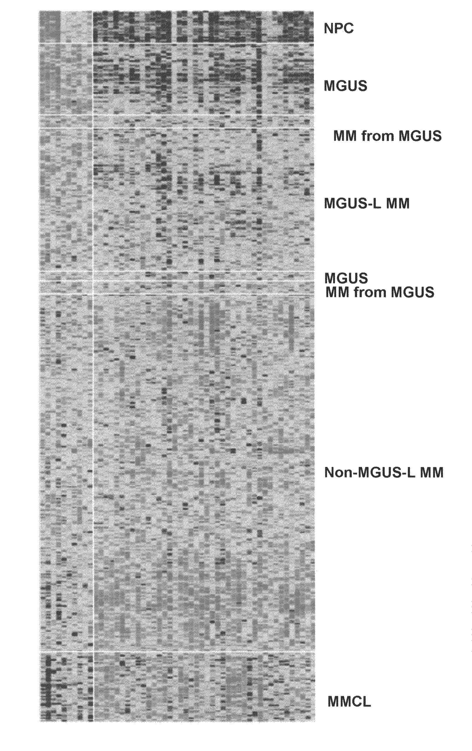 Gene expression profiling based identification of genomic signatures of multiple myeloma and uses thereof