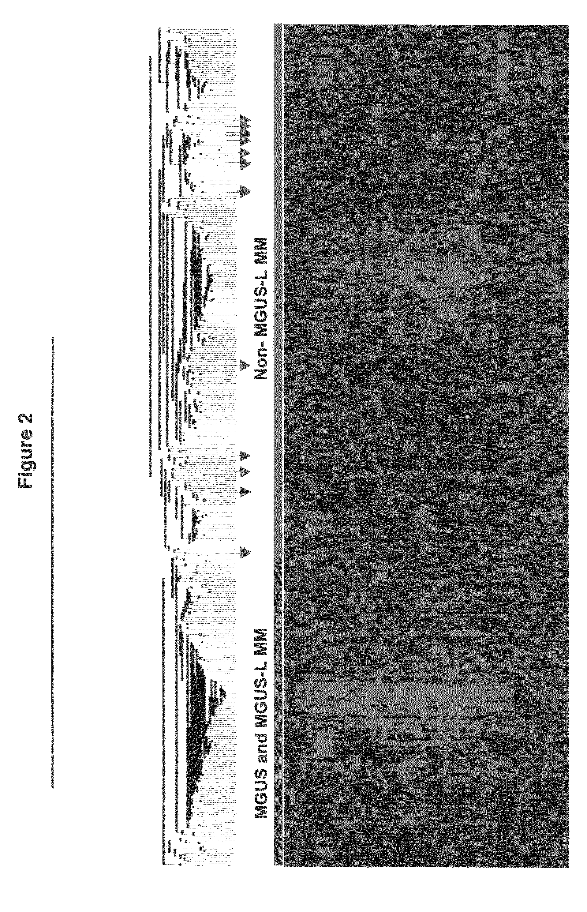 Gene expression profiling based identification of genomic signatures of multiple myeloma and uses thereof