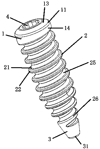 Interference screw for department of orthopaedics