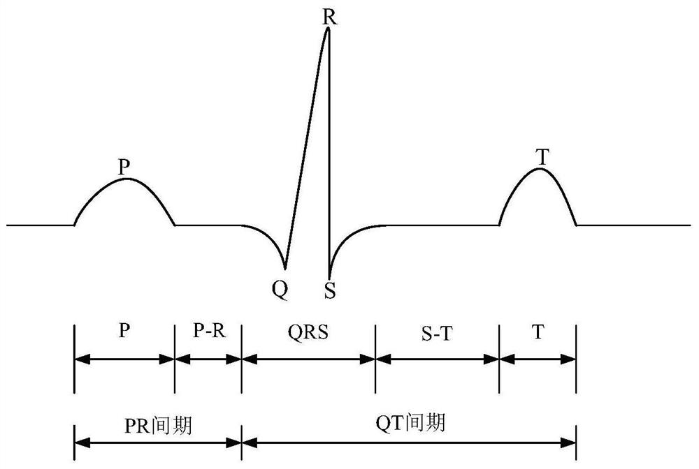 Method, storage medium and device for extracting r-peak moment in electrocardiographic signal data