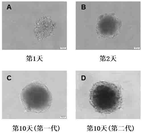 In-vitro construction method of liver cancer organ model