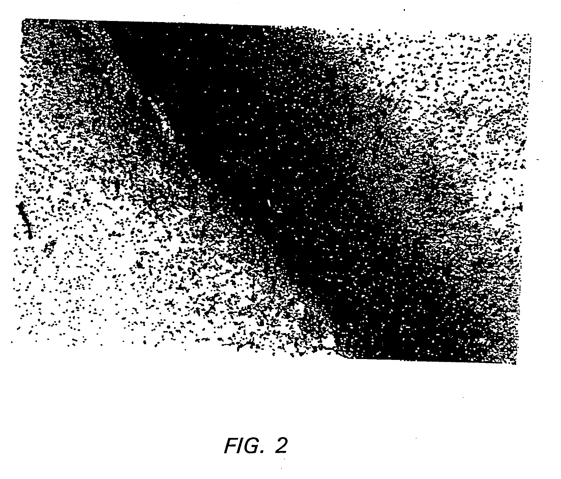 Methods of treating parkinson's disease using viral vectors