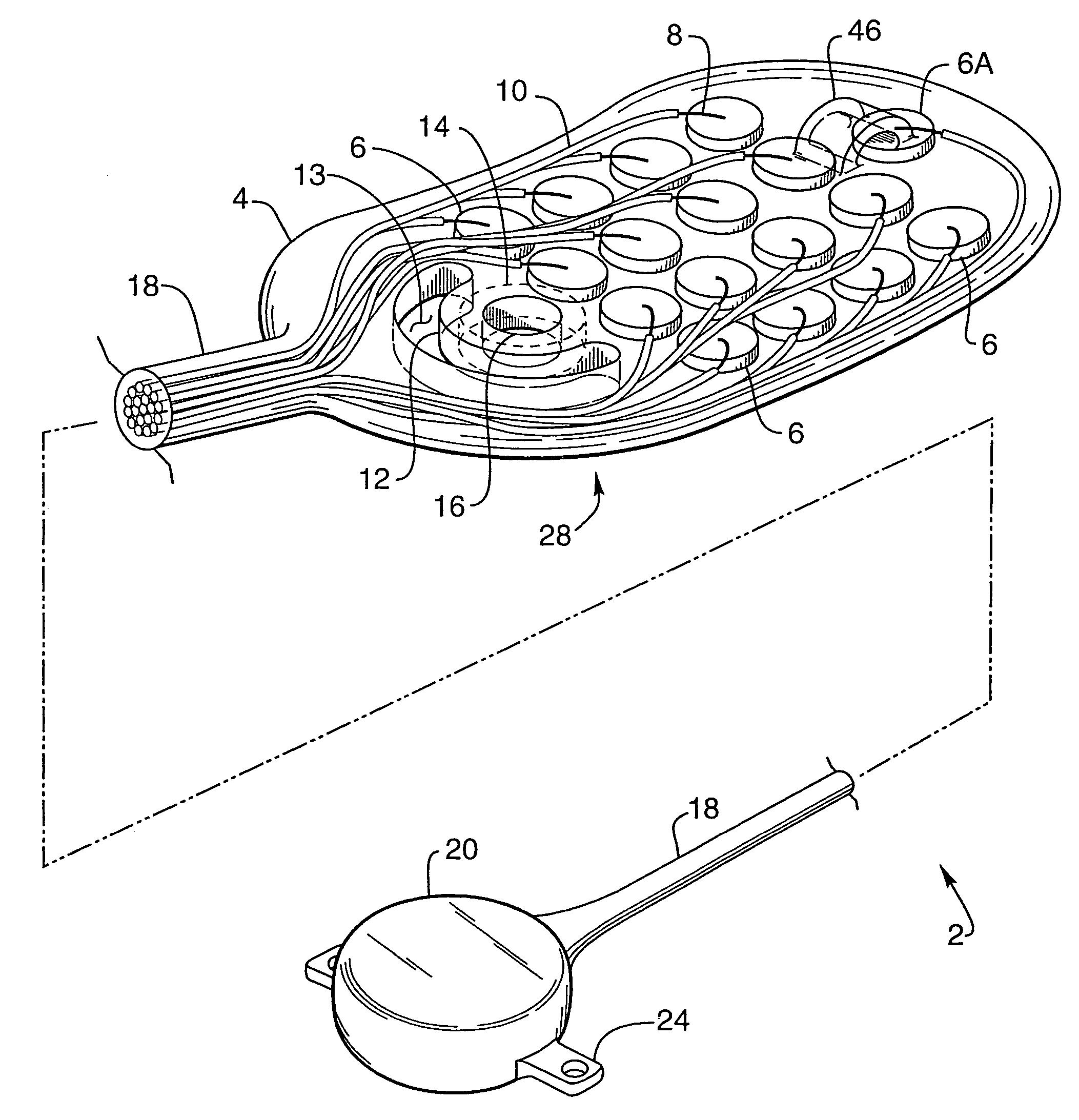 Implantable drug delivery device