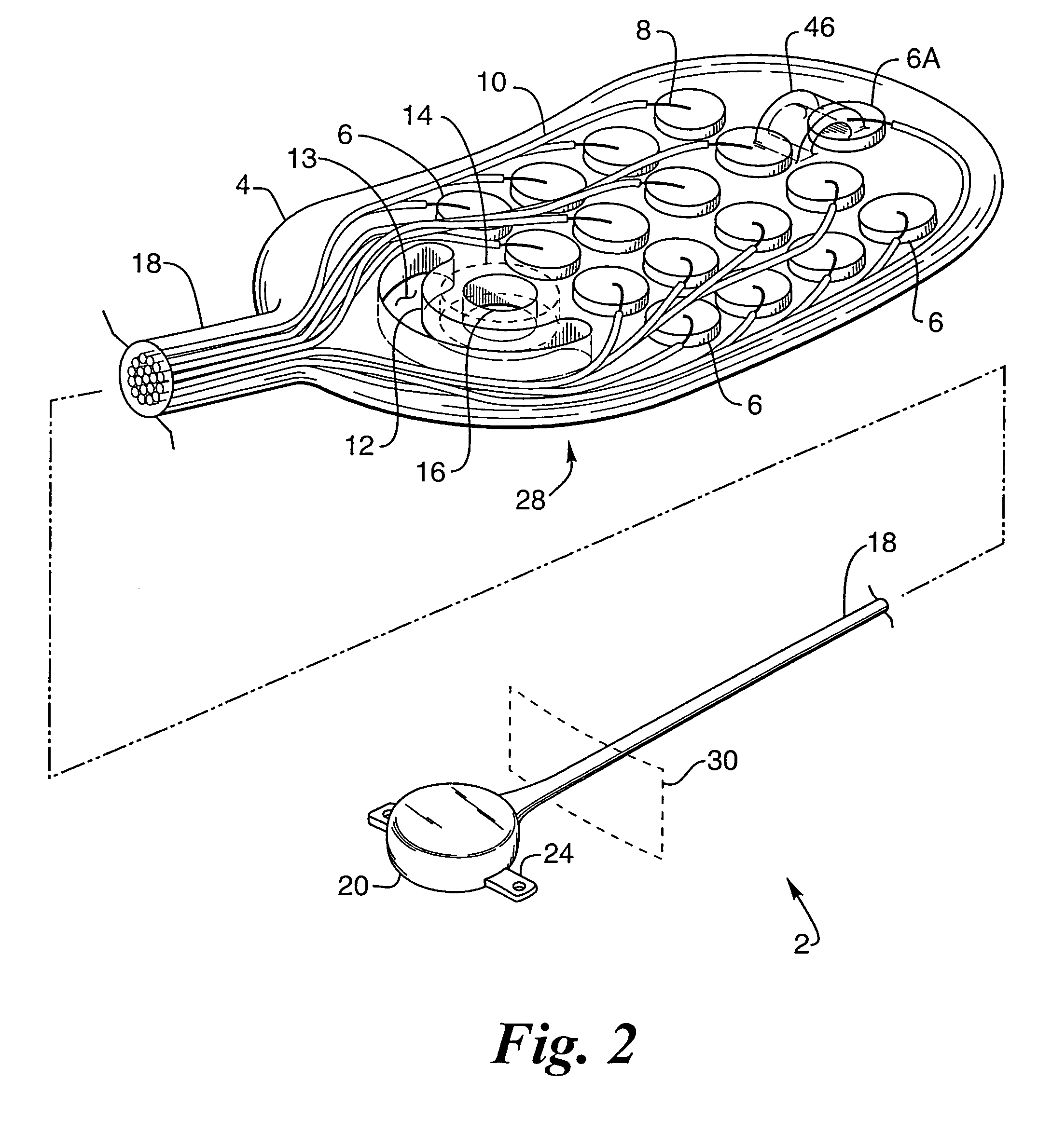 Implantable drug delivery device