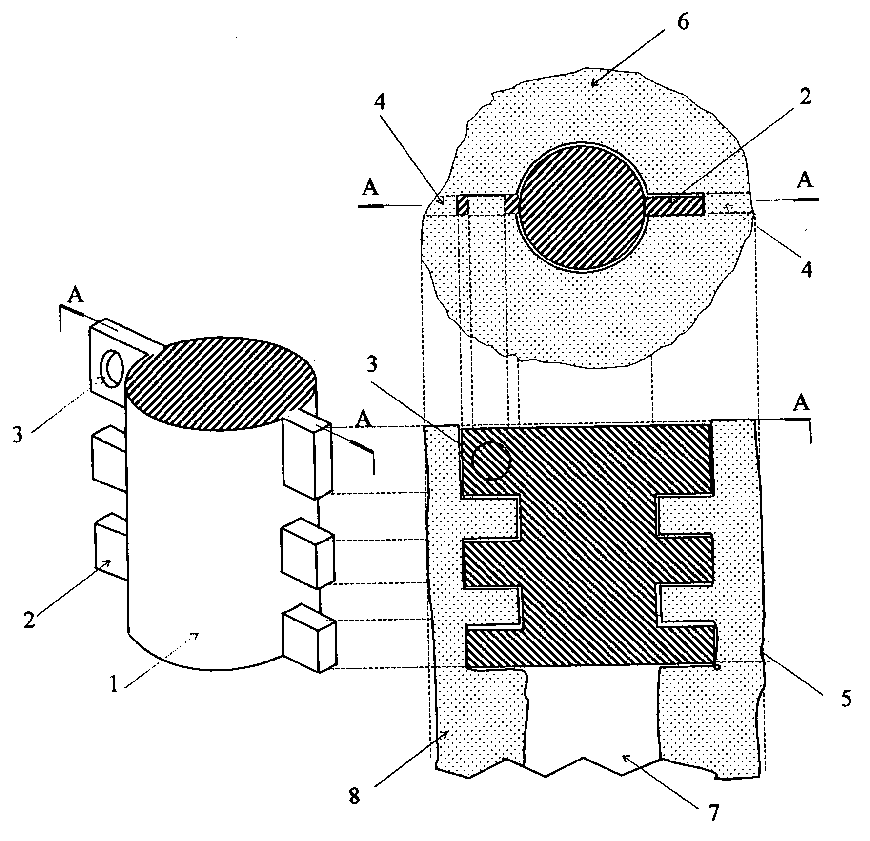 In-bone implantable shaft for prosthetic joints or for direct skeletal  attachment of external limb prostheses and method of its installation