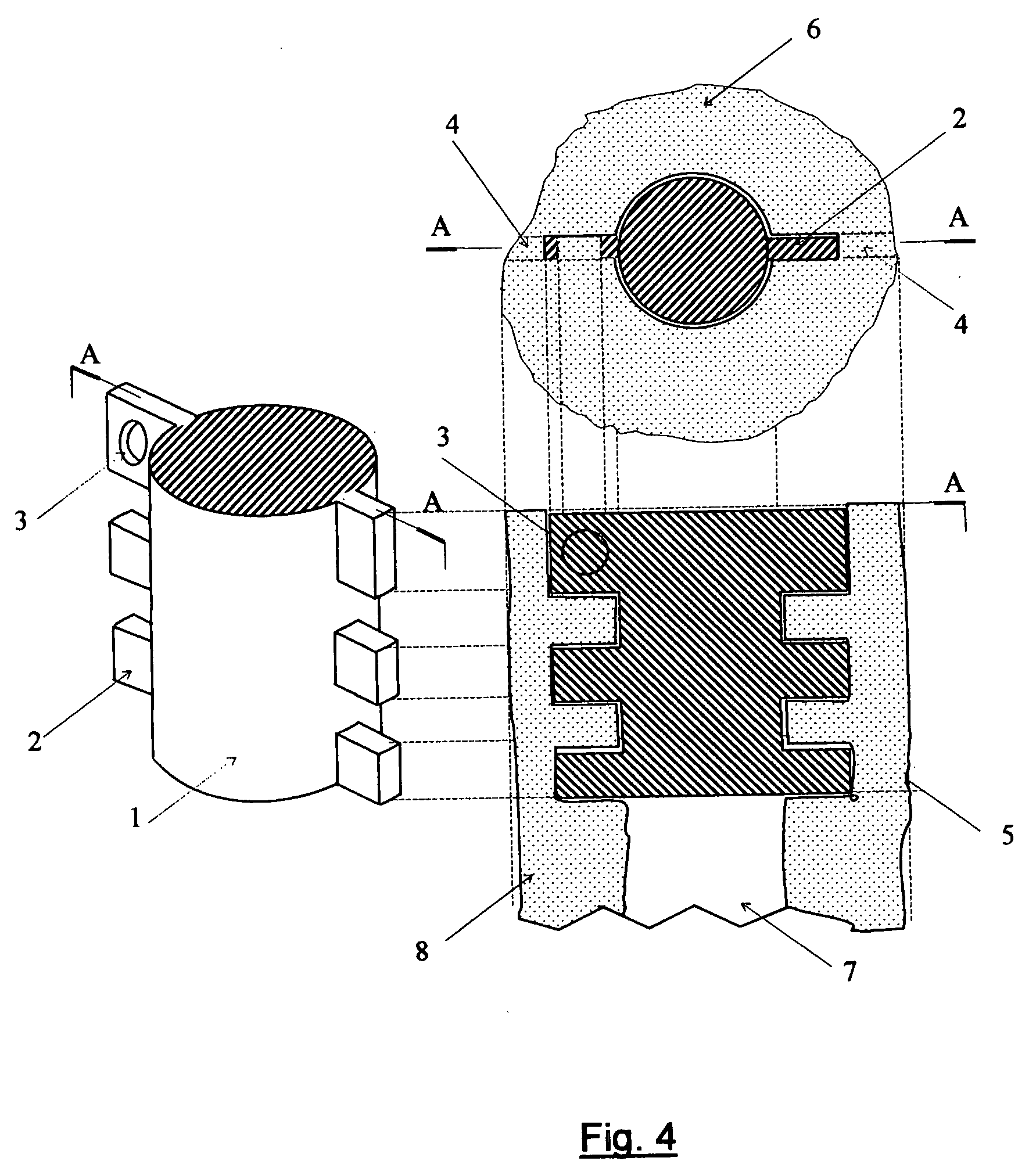 In-bone implantable shaft for prosthetic joints or for direct skeletal  attachment of external limb prostheses and method of its installation