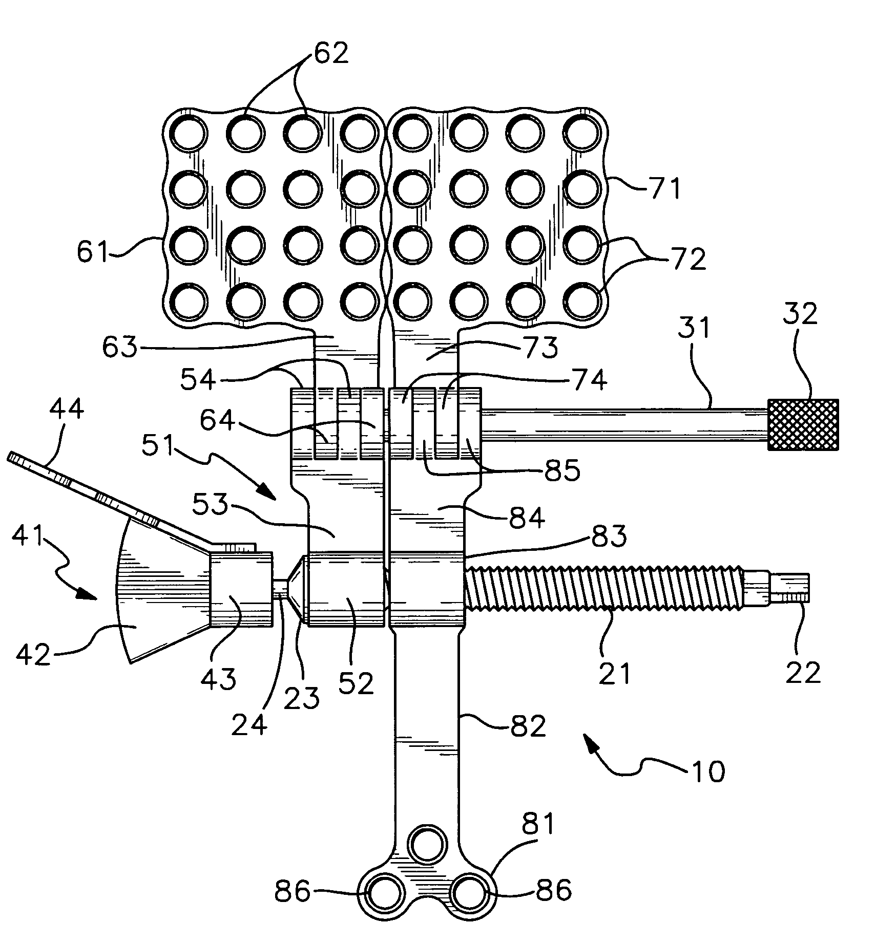 Bone distractor and method