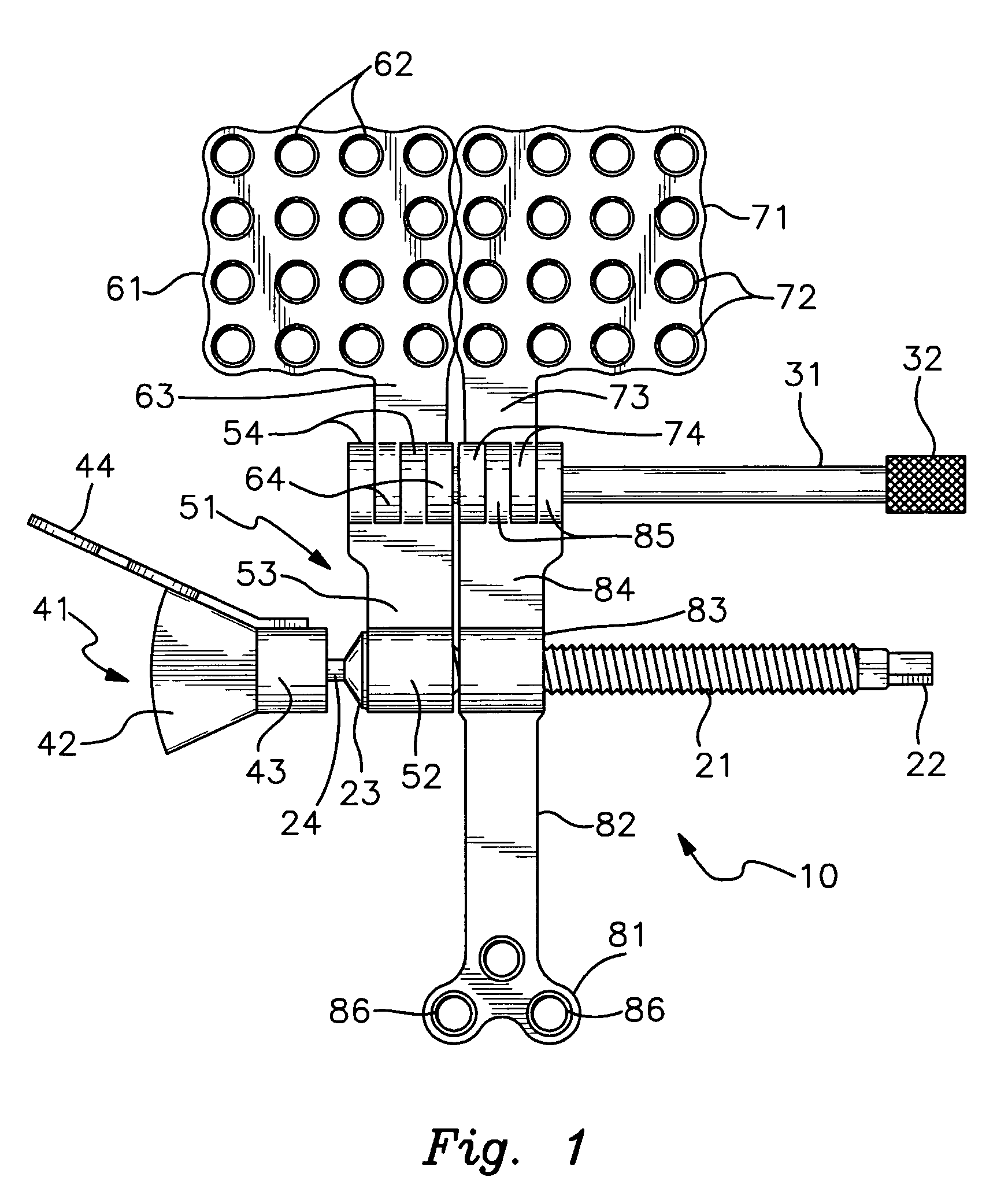 Bone distractor and method